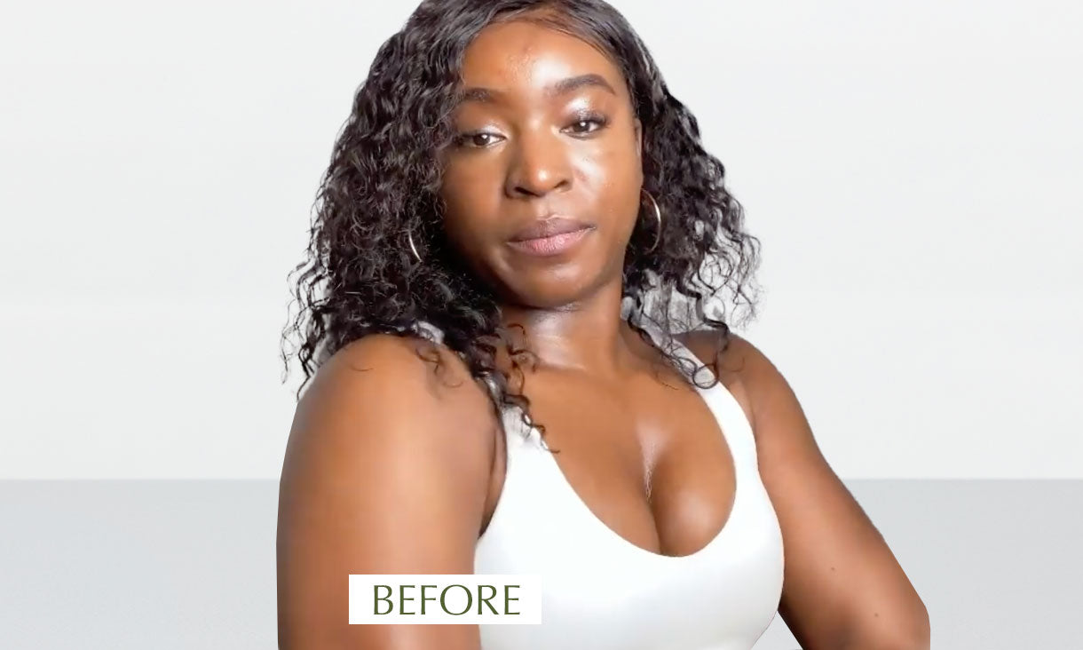 Photo showing a woman with dull, dry, and rough skin before using SUDTANA’s body oil products.