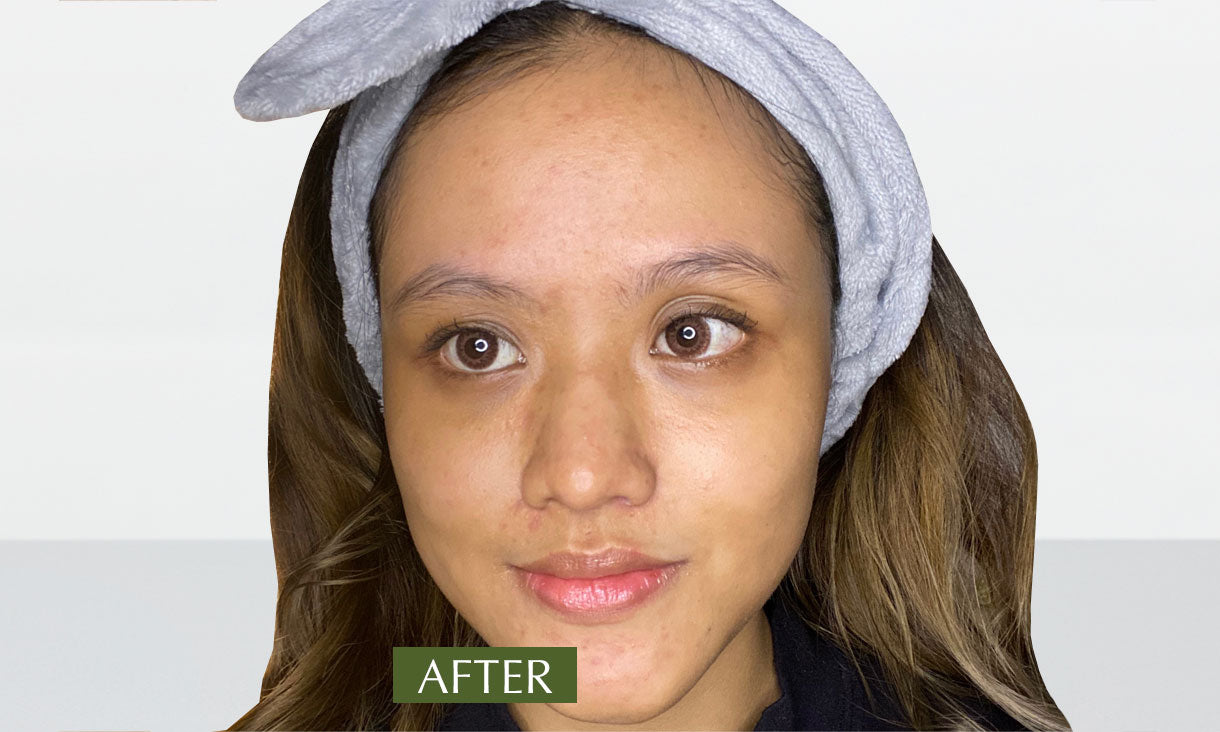 Photo showing a woman with visibly brighter, smoother, and healthier skin after using SUDTANA’s all-natural skincare products.