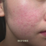 An before-and-after video showing skin before and after using SUDTANA's Kaffir Lime Turmeric & Rice Detoxifying Herbal Mask, showing smoother, clearer-looking skin after use.