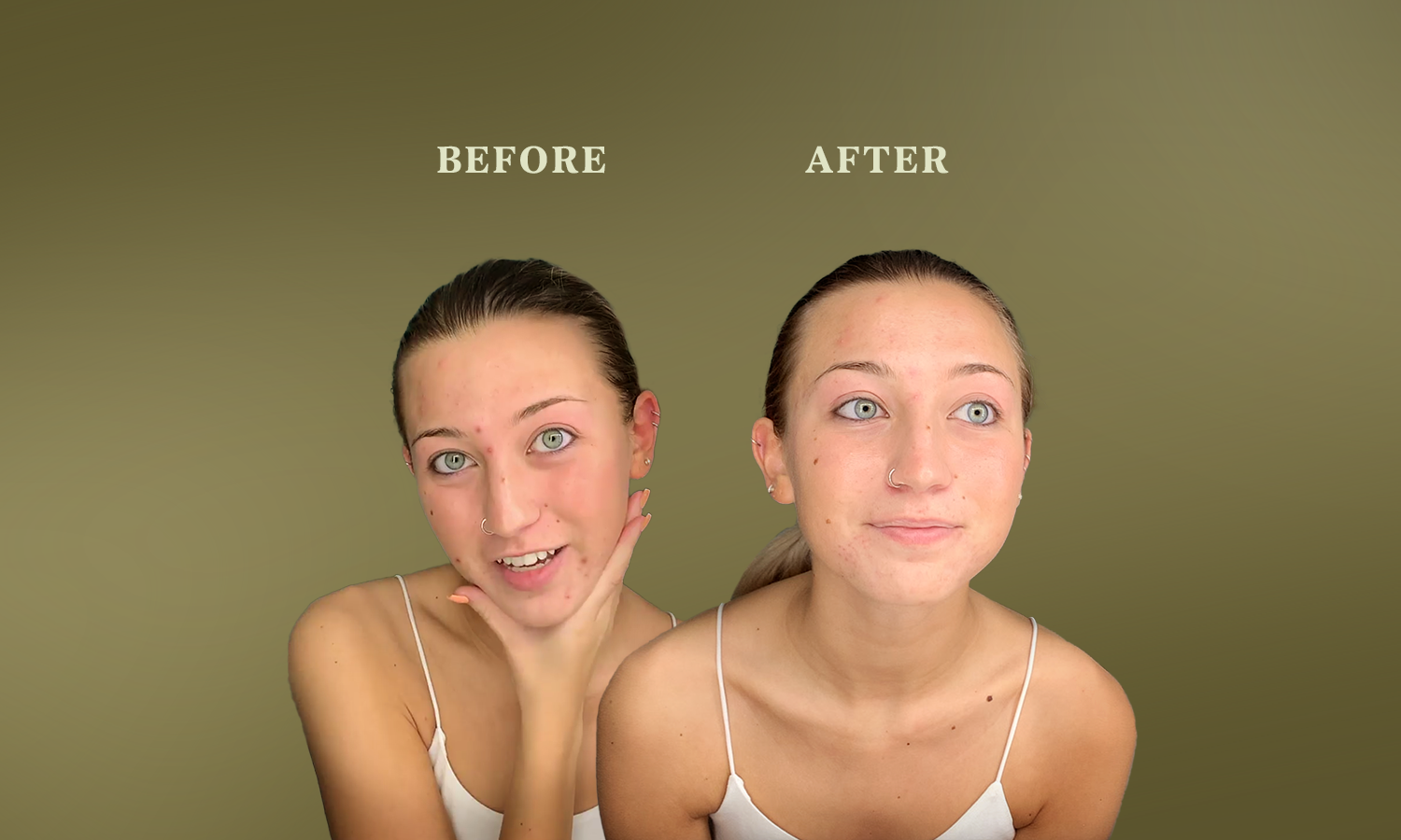 A before and after photo of a customer using SUDTANA’s SGT Facial Oil showing visibly brighter, glowing, youthful skin.